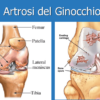 Protesi ginocchio Brescia